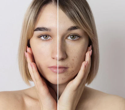 Masajeador facial Trendencias InstaGlow™ "Envio Gratis a todo Paraguay "