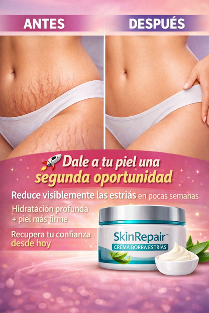 Crema SkinRepair™ – Borra Estrías y Reafirma tu Piel