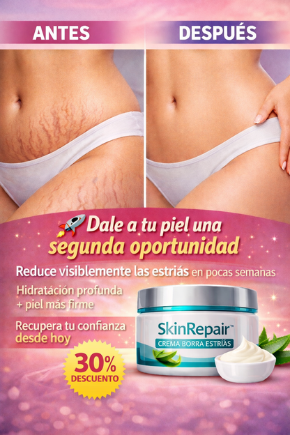 Crema SkinRepair™ – Borra Estrías y Reafirma tu Piel